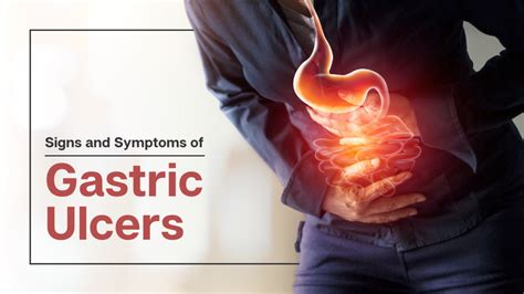 nuts and stomach ulcers.